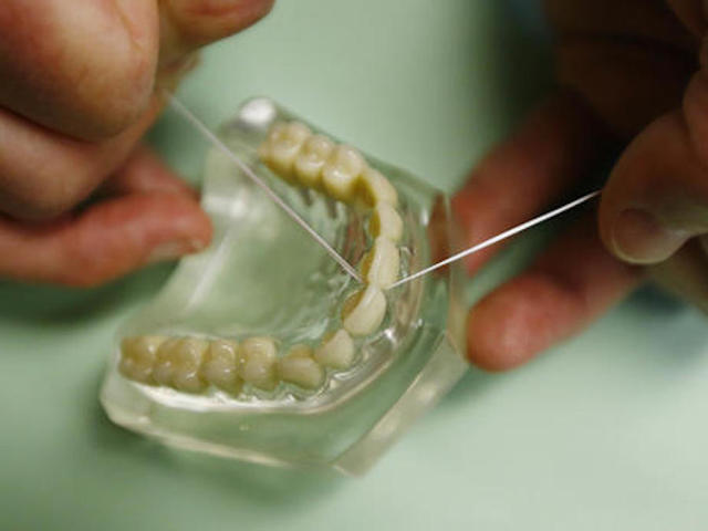 Flossing doesn't do much to prevent disease, Associated Press reports