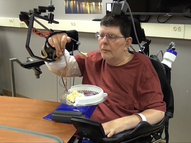 Paralyzed man regains hand movements with experimental device