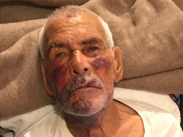 91-year-old man beaten with brick in California, told 'go back to Mexico'