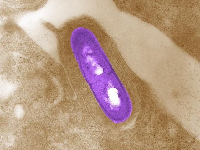 Multistate listeria outbreak prompts recall of Vietnamese pork rolls
